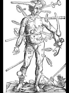 Wound man