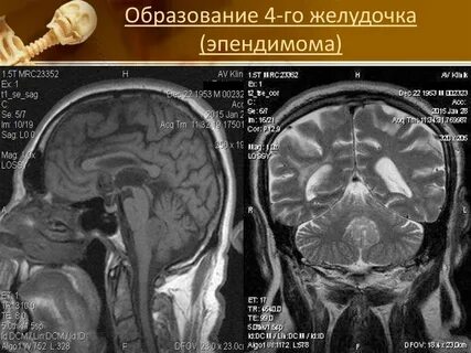 Образование мрт