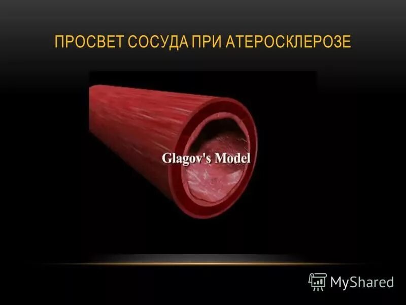 диаметр кровеносных сосудов человека. диаметр просвета сосудов. диаметр просвета сосудов. классификация сосудов по строению и выполняемым функциям. сравнение вен и артерий таблица.