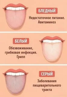 Интоксикация язык
