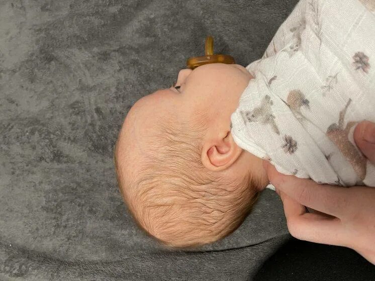 Форма головы у новорожденных. Форма головы у новорожденного ребенка. Формы черепа у новорожденных. Нормальная форма головы у новорожденных.