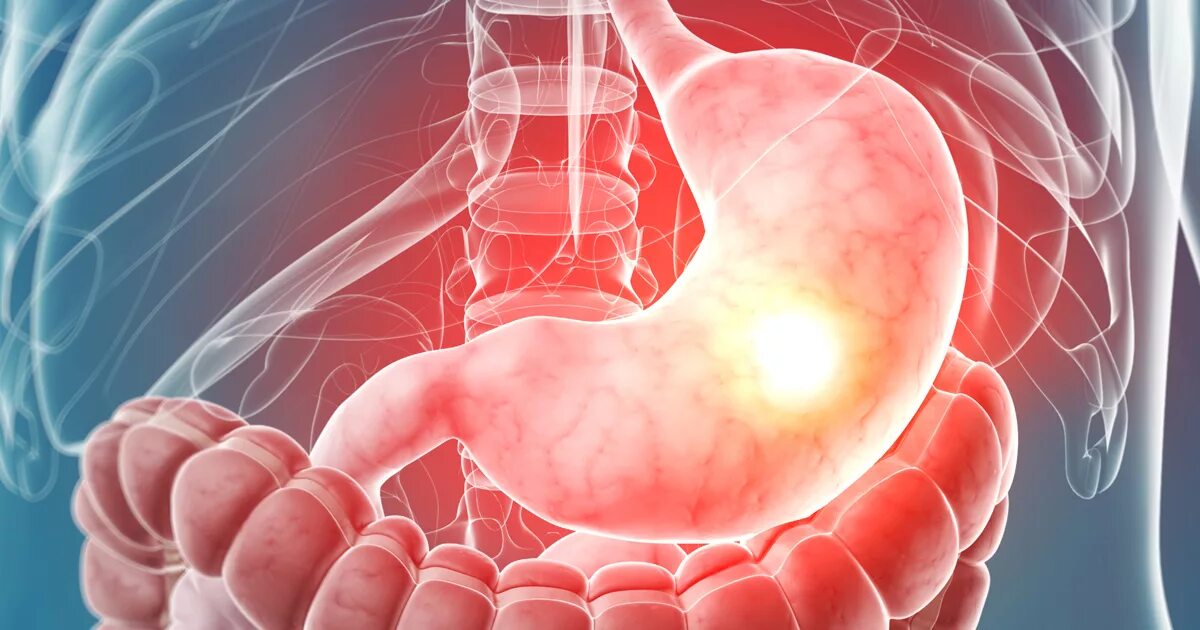 Функциональные нарушения книга. Влияние стресса на пищеварительную систему. Болит живот на нервной почве. Влияние стресса на желудочно-кишечный тракт. Невроз желудка симптомы.