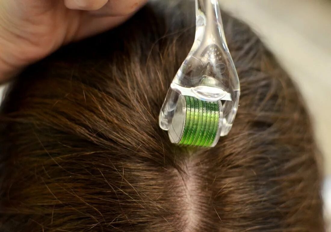 Стимулирование волос. Мезороллер для головы. Мезороллер для волос. Мезотерапия для волос. Мезороллер для кожи головы.