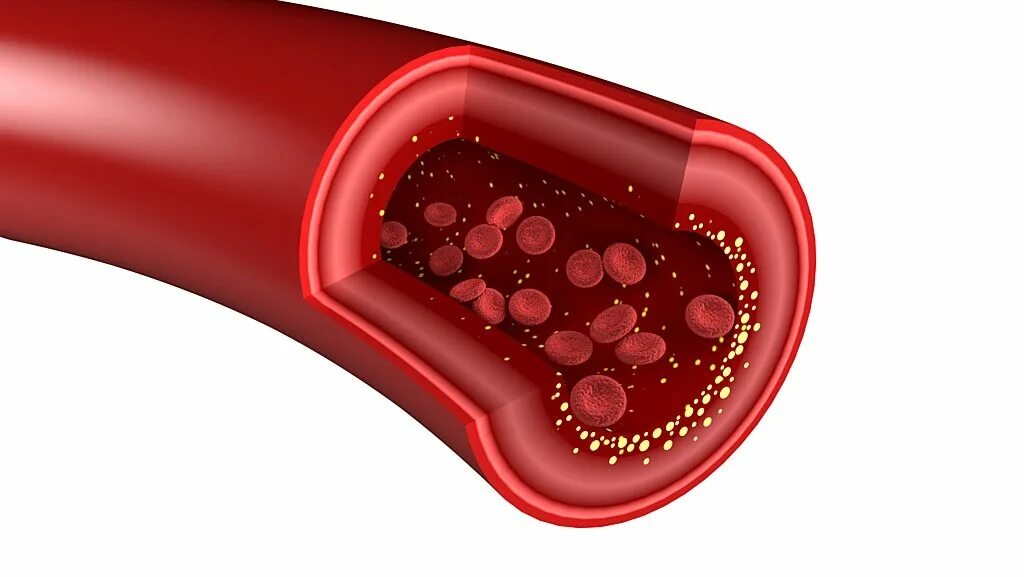 Холестерин колбаса. Cholesterol Act Plus. Cholesterol PNG.