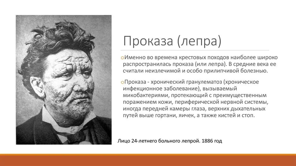 Проказа болезнь симптомы. Слова проказа. Средневековая болезнь проказа. Проказы что означает слово. Болезнь проказа в средние века.