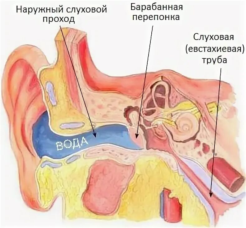 Попадания воды в среднее ухо. Жидкость из среднего уха.