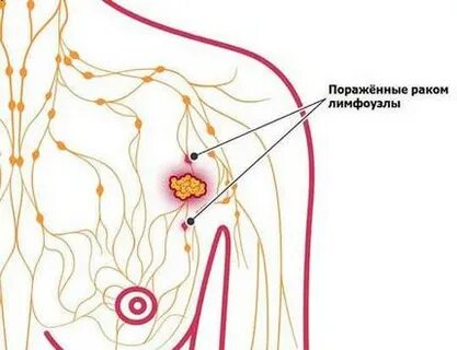 Каких размеров лимфоузлы