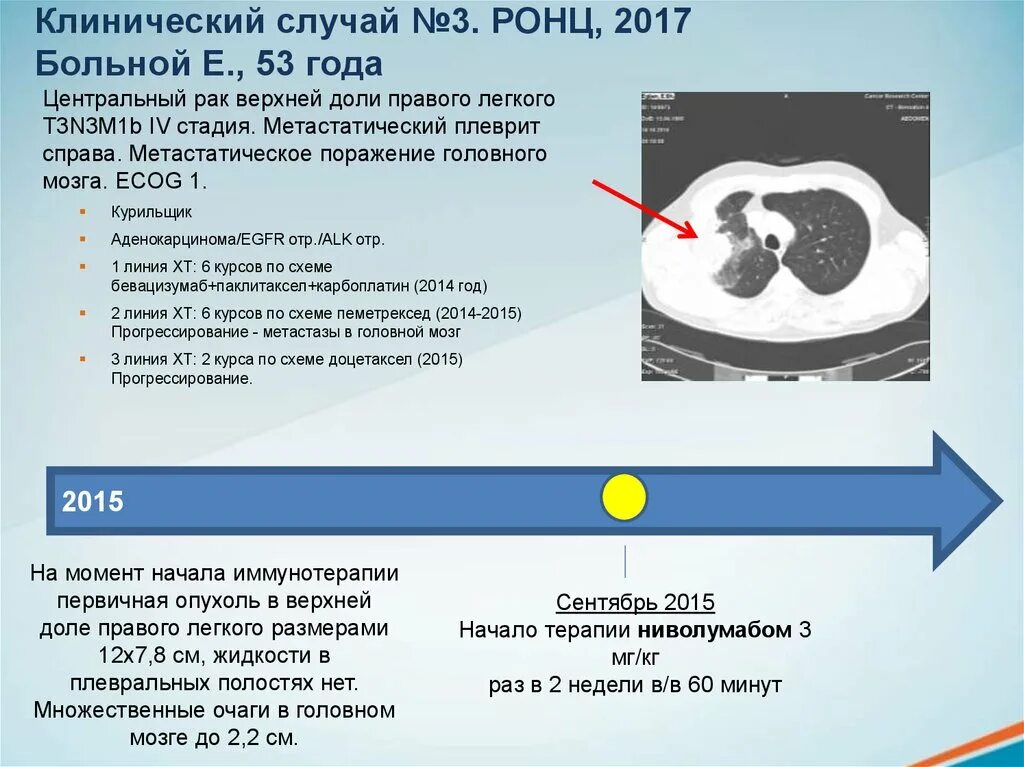 Онкология клинический случай презентация. Клинические случаи в терапии. ECOG В онкологии. Местнораспространенная опухоль. Рак легких отзывы пациентов