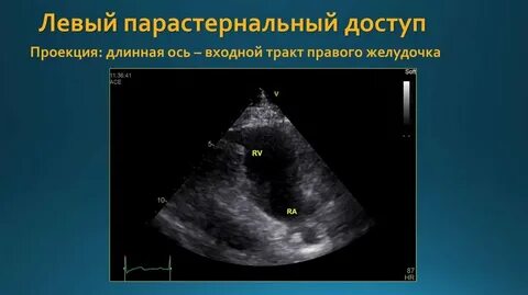 Оси правее