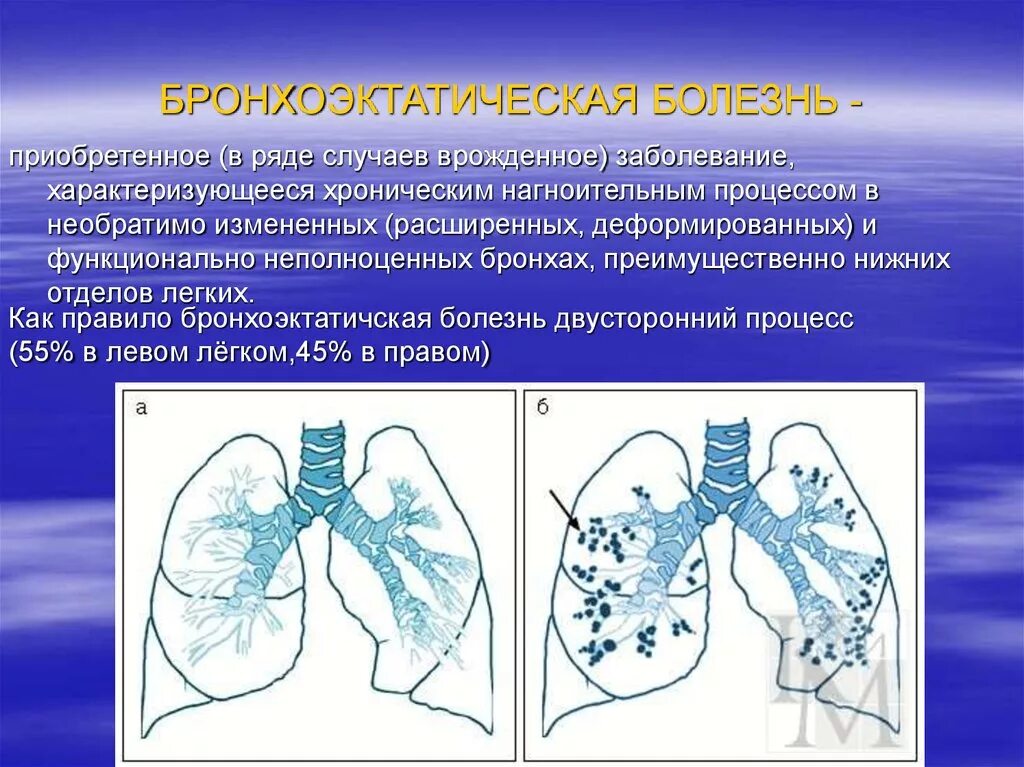 Бронхоэктатическая болезнь. Лечение при бронхоэктатической болезни. Симптомы характерные для бронхоэктатической болезни. Мешотчатые бронхоэктазы рентген. Легочная ткань бронхоэктатическая болезнь.
