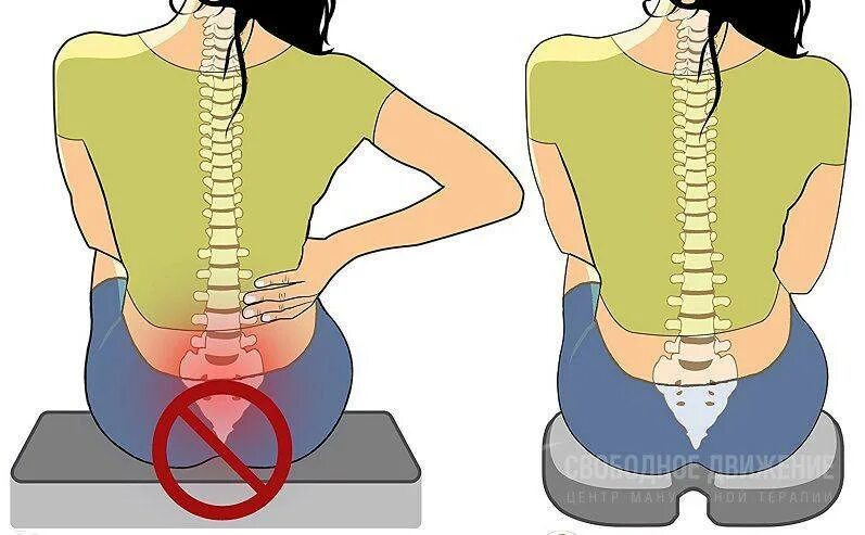 Боль в спине крестец. Позвоночник копчик. Позвоночник в области поясницы.
