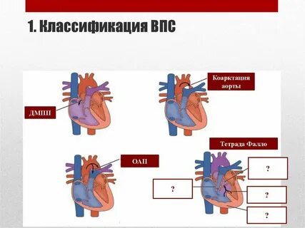 Впс2 чи