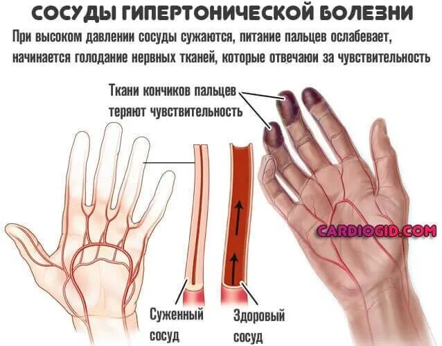 Почему у меня палец