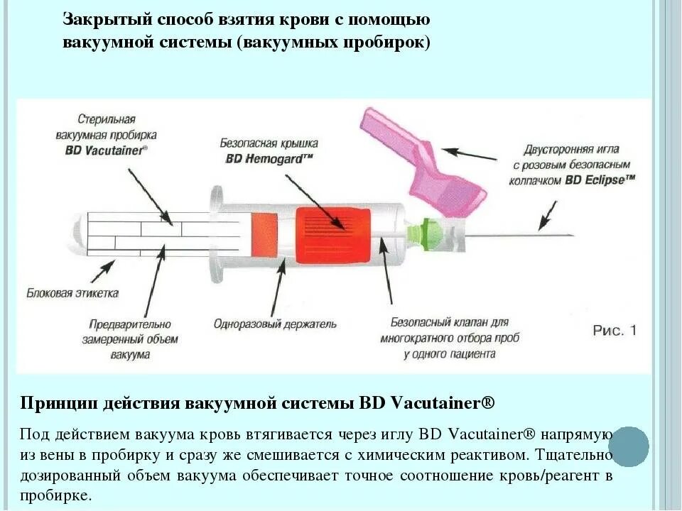 Почему свернулась кровь из вены. Система вакутейнер для взятия крови. Система для забора крови вакутайнер. Забор крови в вакуумные пробирки алгоритм. Алгоритм взятия крови из вены вакутейнером.