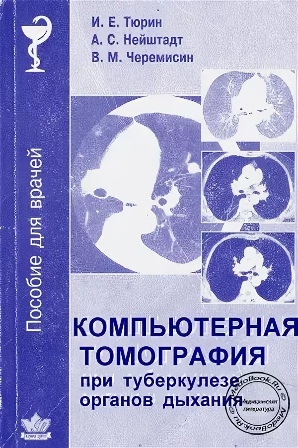 Туберкулез учебник. Книги по кт. Компьютерная томография книга. Компьютерная томография органов дыхания Тюрин.