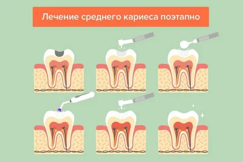 Зуба этапы