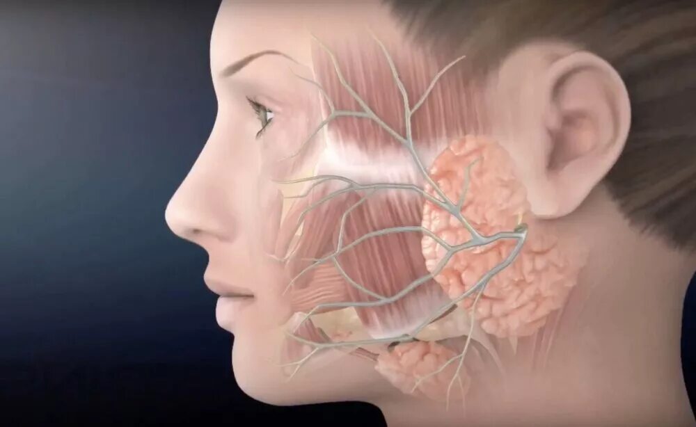 Лицевой нерв после операции. Опухоль околоушной слюнной железы. Шишка в околоушной слюнной железы. Онкология околоушная слюнная железа. Околоушная слюнная железа 3д.