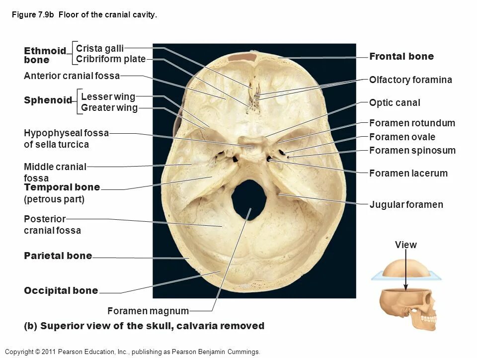 Скат анатомия черепа латынь. Яремное отверстие черепа. Отверстия черепа анатомия. Основание черепа анатомия человека. Отдельный отверстие