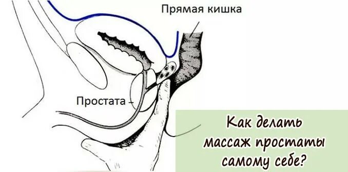 Простата урок. Схема массажа простаты пальцем. Как сделать массаж простаты самому себе. Как самому делать массаж простаты пальцем правильно. Схема как сделать массаж простаты.