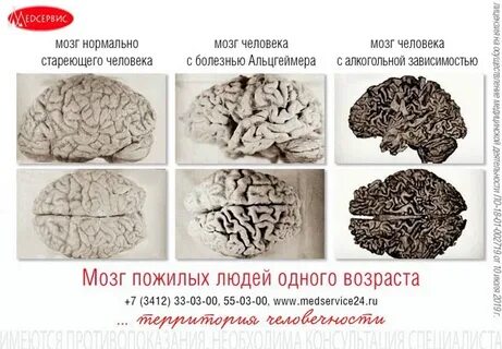 Мозги нормально