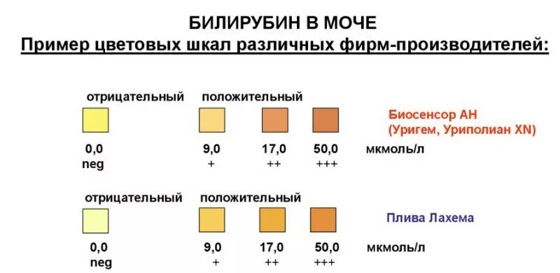 Уробилиноген в моче у мужчины повышены. Норма билирубина в моче в мкмоль/л. Билирубин в моче 17 мкмоль. Уробилиногена и билирубина в моче норма. Прямой билирубин в моче в норме.