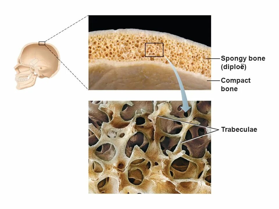 The bones consist of