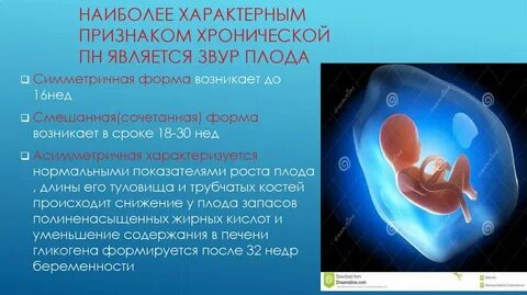 Звур форум