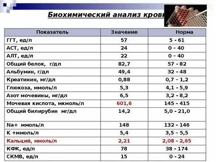 Общая биохимия это