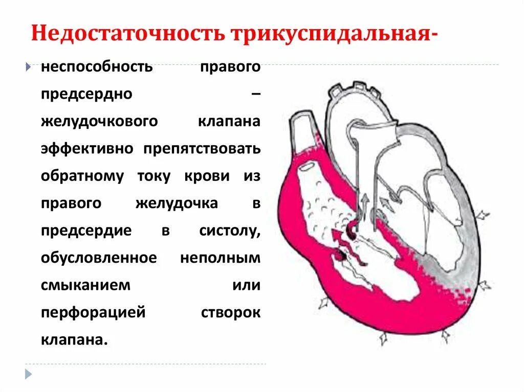 Гемодинамика степени. Недостаточность трикуспидального клапана гемодинамика. Недостаточность трехстворчатого клапана 1 степени. Недостаточность трикуспидального клапана 2-3 степени. Трикуспидальный клапан сердца 1 степени недостаточность.