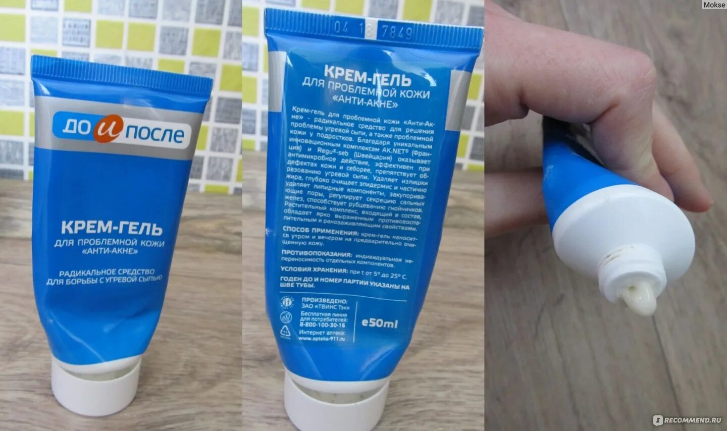 крем гель для лифтинга кожи. система 2 в 1 для кожи вокруг глаз "лифтинг-эффект. эвиналь крем лифтинг с экстрактом плаценты. кора крем гель ревитализант. крем гель для лифтинга кожи.