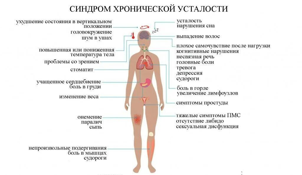 Хроническая усталость симптомы. Синдром хронической усталости симптомы. СХУ симптомы. Синдром усталости симптомы. Слабость без видимых причин