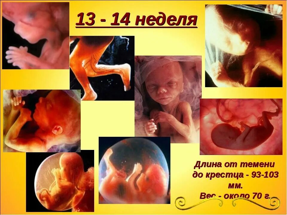 Беременность 13 мм. Ребёнок на 14 неделе беременности. Плод на 14 неделе беременности. 13 Недель беременности размер плода.