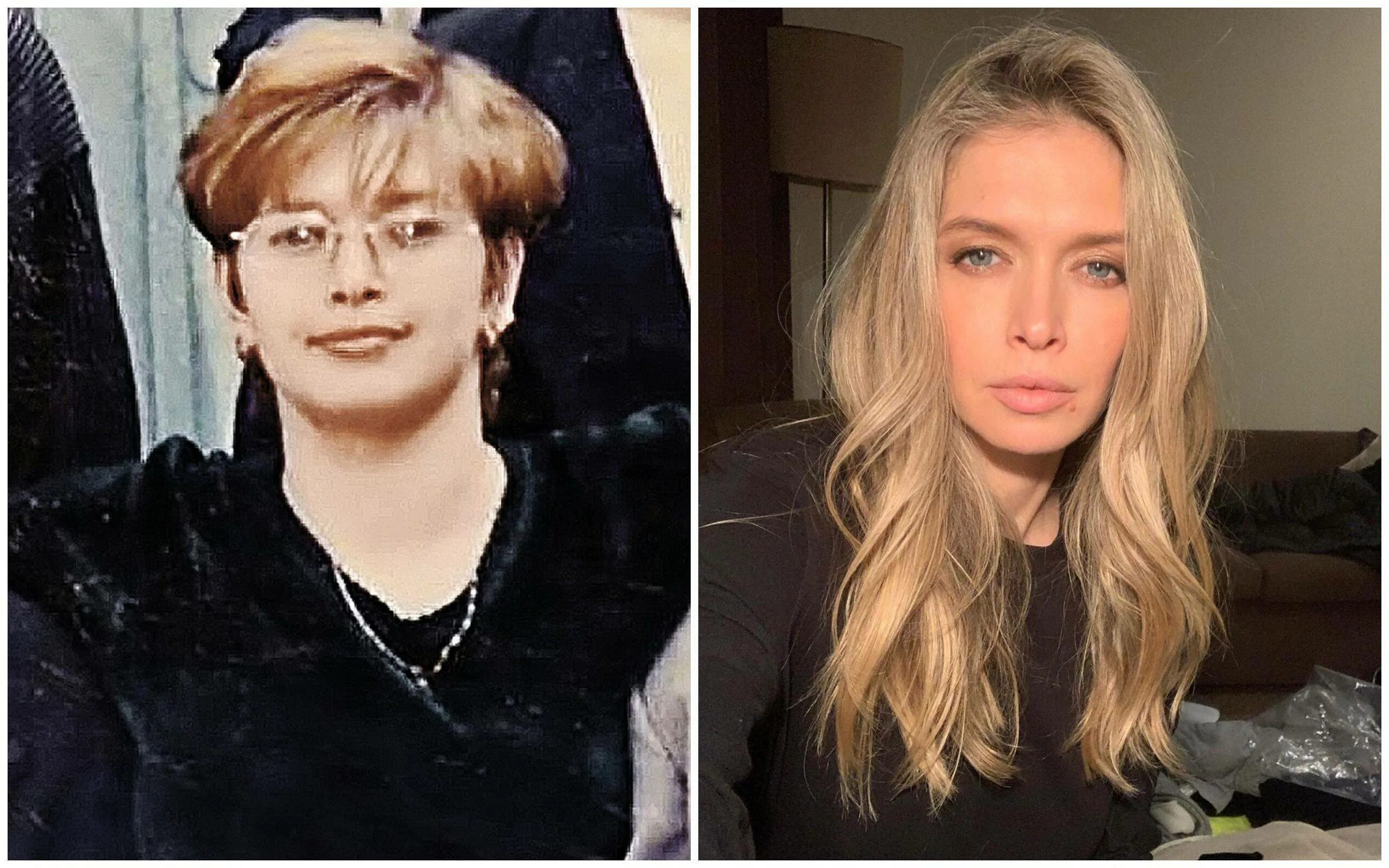 Вера Брежнева до и после пластики лица (Фото) Умница-Красавица