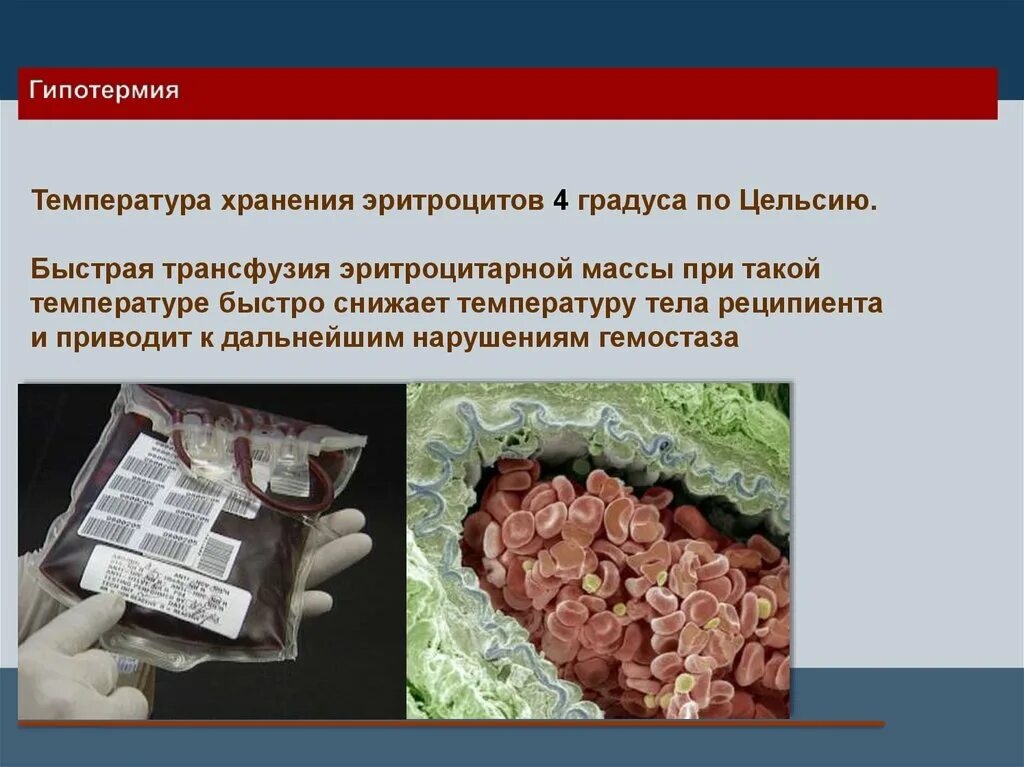 Срок хранения эритроцитов. Температура хранения эритроцитарной массы. температура хранения эритроцитной массы. хранение эритроцитарной массы. условия хранения эритроцитарной массы.
