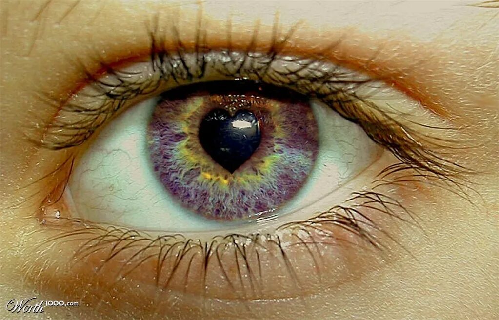 Точки на радужной оболочке. Иридодиагностика глаза. Звездчатая радужка глаз. Болезни радужки
