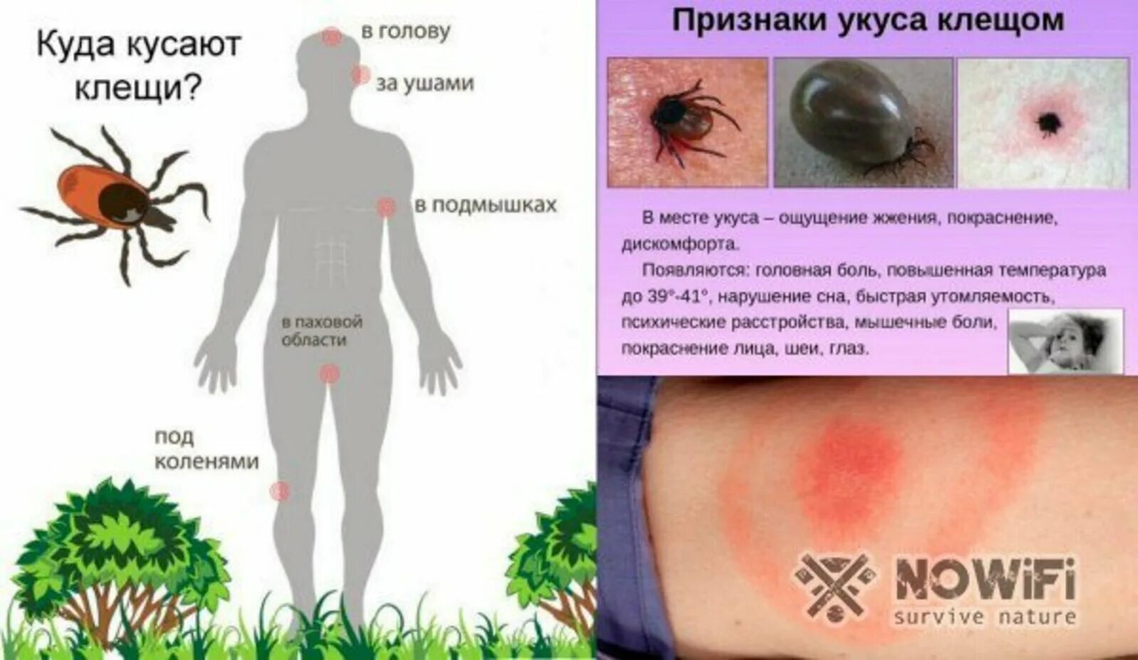 Укусы насекомых Частная поликлиника "Здоровейка" Липецк