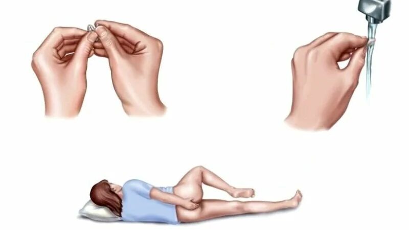 Что такое ректальное введение свечей. Как ставить свечи ректально ребенку 1 год. Упражнение ноги на стену. Как лежать после свечки. Как лежать после свечки.