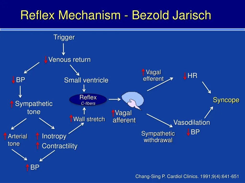 Рефлекс Bezold-Jarisch. Reflex Syncope. Рефлекс Бецольда Яриша схема. Рефлекс Бецольда Яриша механизм.