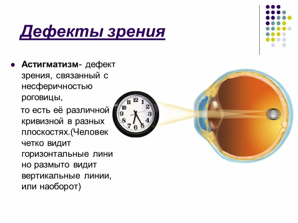 Глаз и зрение физика 9. Нарушение зрения таблица астигматизм. Дефекты зрения астигматизм. Глазные дефекты зрения. Дефекты зрения человека.