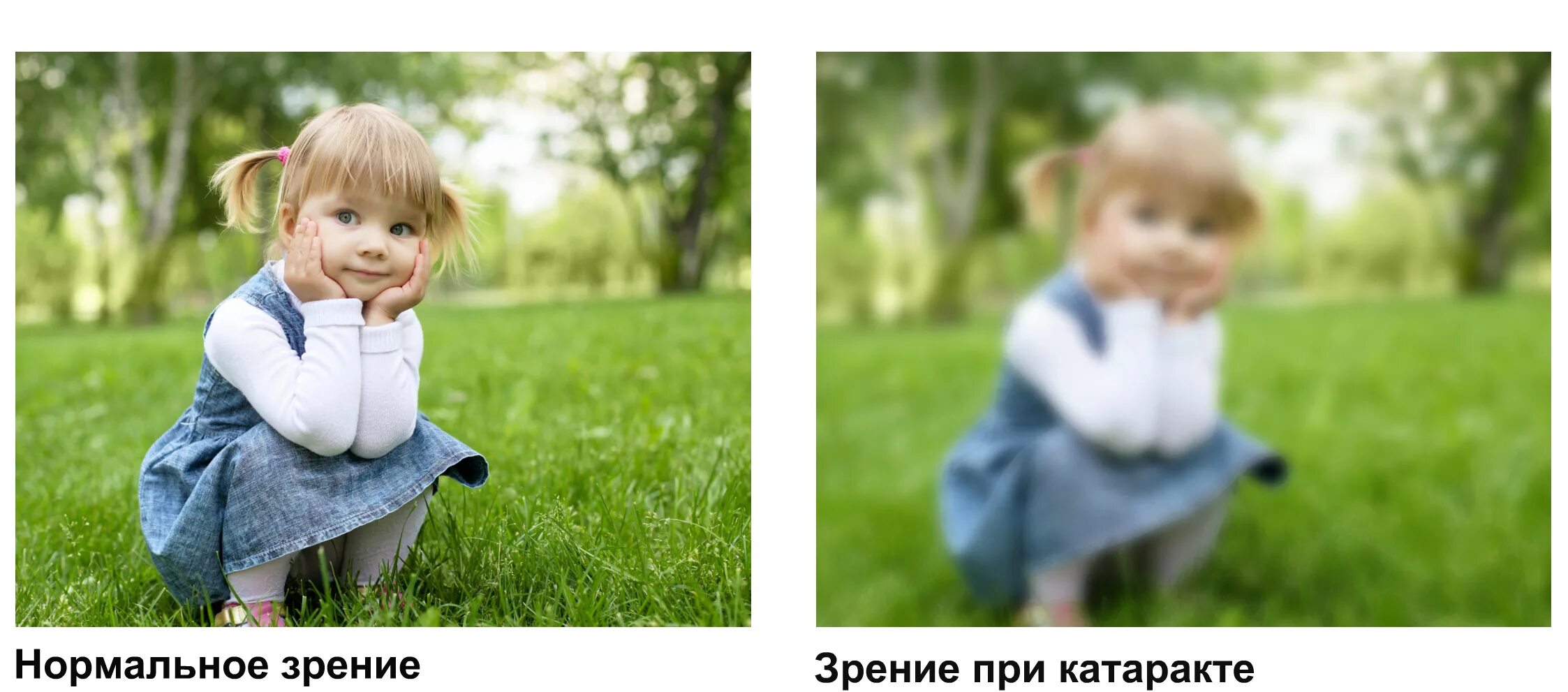 Как видят при катаракте. Как видит человек с катарактой. картинка при катаракте. как видит человек с катарактой картинки.