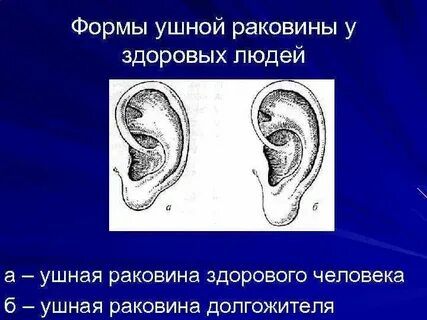 Ушные раковины тип
