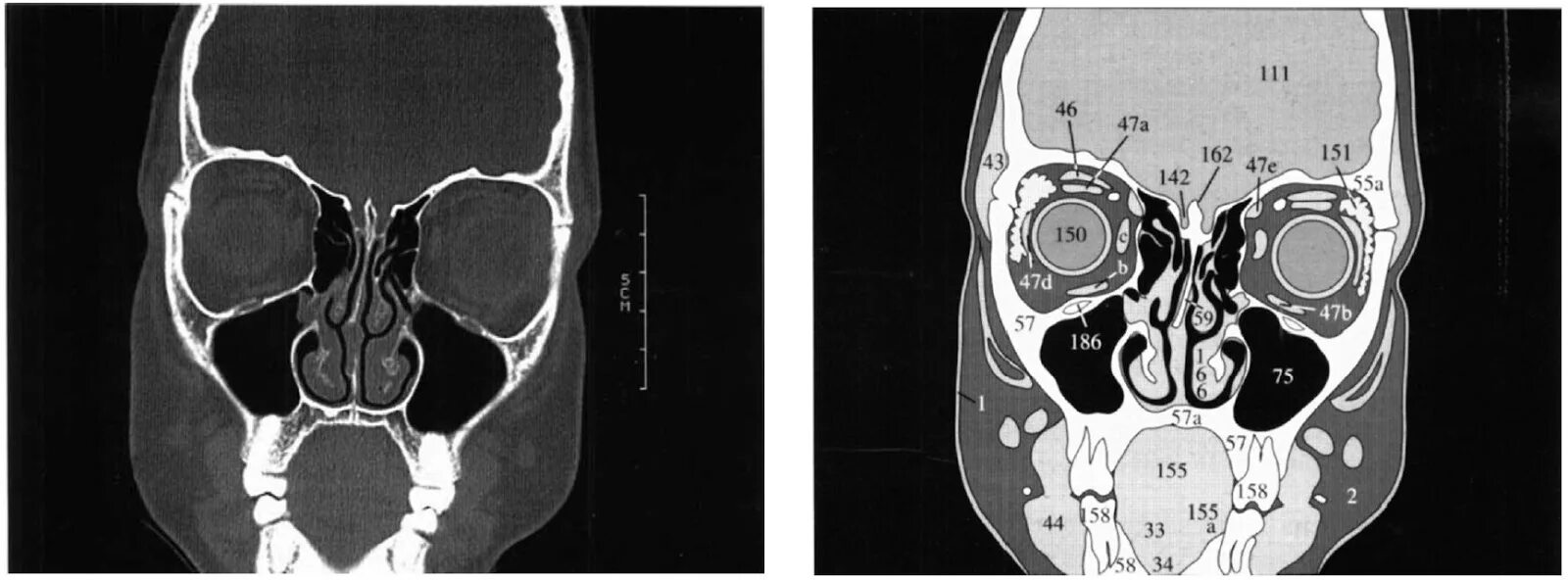 Компьютерная томография срезы. Анатомия аксиальные срезы. Компьютерная томография срезы. Срезы кт. Компьютерная томография срезы.