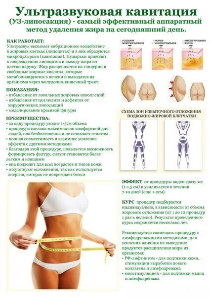 Ультразвуковая кавитация схема. Кавитация ультразвуковая+вакуумный массаж. Аппаратная коррекция фигуры. Массаж аппаратный вакуумный для похудения. Как часто можно делать рф