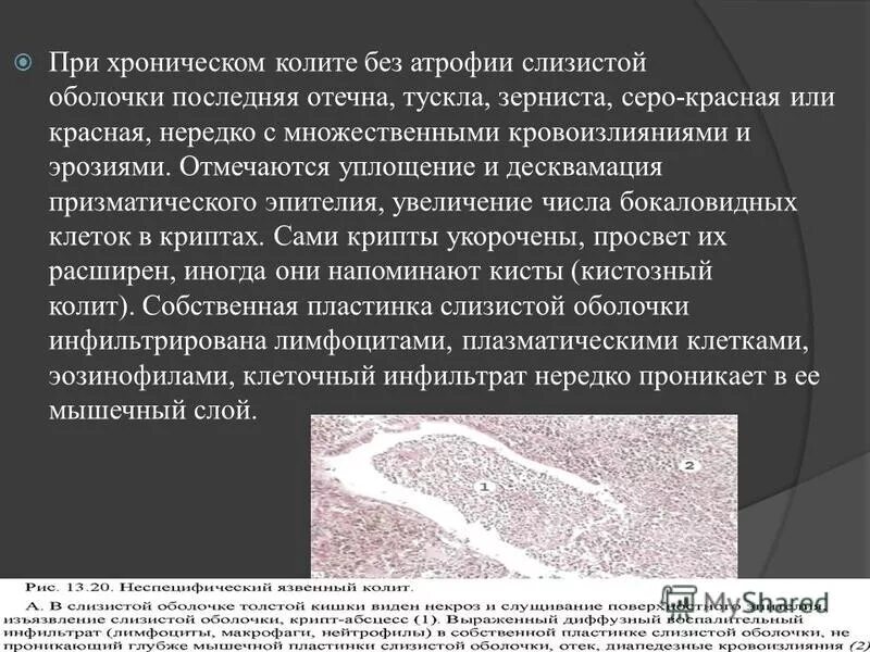 Десквамация эндометрия. Десквамация кишечного эпителия. Очаговая десквамация покровного эпителия кишечника. Десквамация эпителия процесс.