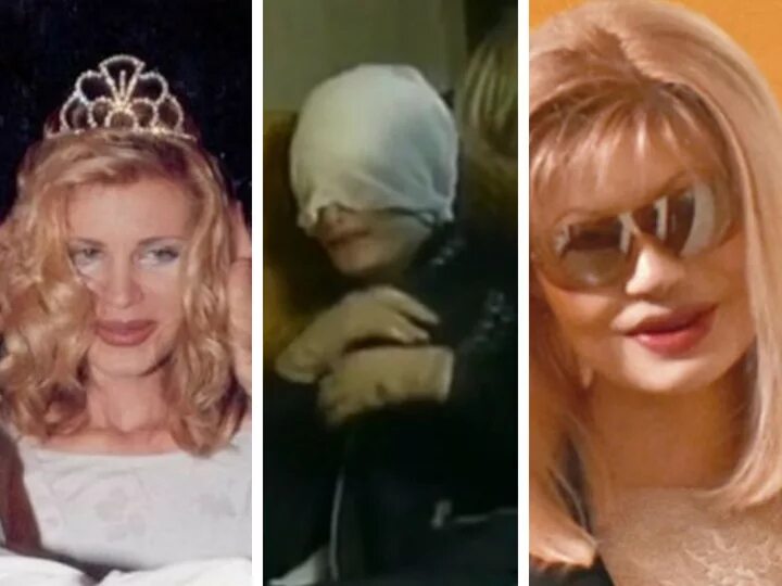 элеоноре кондратюк фото до и после. элеоноре кондратюк фото до и после. мисс очарование элеонора кондратюк. элеонора кондратюк облили кислотой. элеонора кондратюк и рубен григорян.