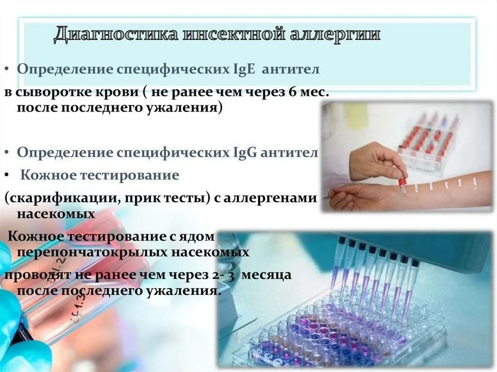 Специфические пробы. Методы диагностики аллергических реакций. Диагностика кааллергических реакций. Лабораторные методы диагностики аллергии. Методы выявления аллергии.