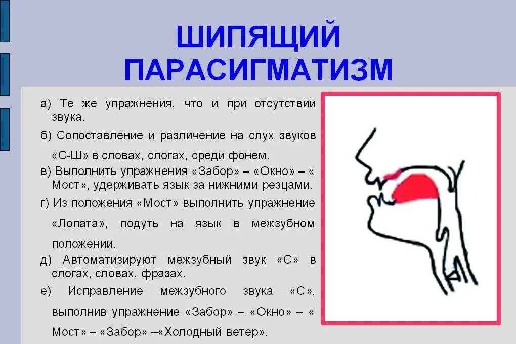 Артикуляцией называется. Губно-зубной сигматизм шипящих звуков. Межзубный свистящий сигматизм. Губно-зубной парасигматизм шипящих коррекция. Шипящий сигматизм.