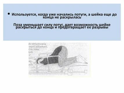 Позы для быстрого раскрытия шейки матки