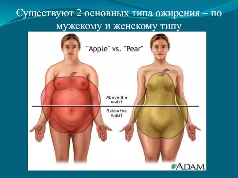 Глютеновое ожирение у женщин. Типы ожирения яблоко и груша. Ожирение по типу яблоко и груша. Ожирение по типу фигуры. Типы ожирения у женщин.