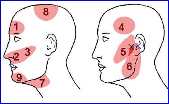 Почему давит на уши. Болит под ухом при нажатии. Иррадиация болей в ухо и висок.